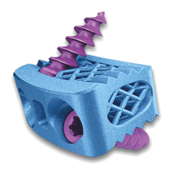 3D-Ti Cervical Locking Cage