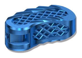 3D-Ti TLIF