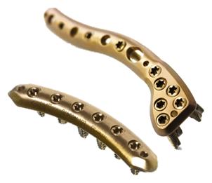 5.0ChLP Clavicle S Plates