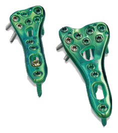 4.0ChLP Distal Radius Volar Plates