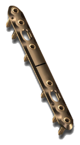 5.0ChLP Forearm Straight Plates