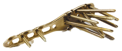 5.0ChLP Proximal Humerus Plates