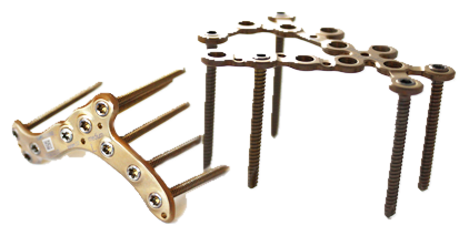 5.0ChLP Calcaneal Plates